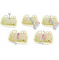 GDC Root Elevator Set Of 9 In Pouch
