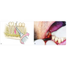 GDC Root Elevator Set Of 9 In Pouch (RESP9)