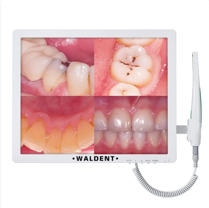 Waldent Intraoral Camera Smart -Cam with PMS