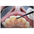 GDC Comp Anterior Extra Flex Blue # TNCIGFTM11