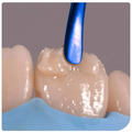 GDC Comp Anterior Extra Flex Blue # TNCIGFTM11