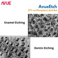 Dental Avenue Avue Etch