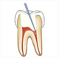 GDC Endo Explorer DG16 Standard EXDG16