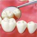 GDC Mouth Mirror Tops Fs Rhodium Coated Pack Of 12 Pcs - 4 (Mmtfs4)