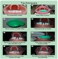 Prevest DenPro OraTemp C&B Temporary Crown & Bridge Material – 67g Automix Cartridge