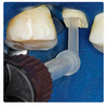 Wizdent Wonder Edge Dc - 3 in 1 core build-up, post & crown cementation material